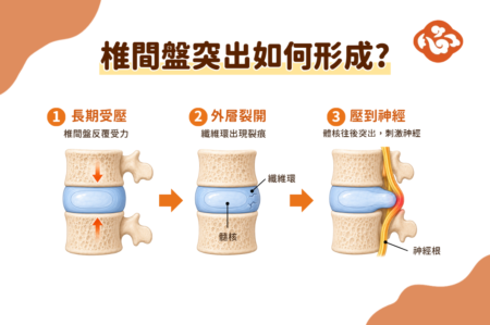 久坐伤腰又伤脑!四动作与健步汤可自救