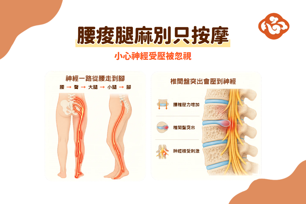 腰痛合併腿麻、電流感,不一定只是肌肉痠。當椎間盤突出壓迫神經,症狀可能沿著坐骨神經一路傳到腿腳。(醫道心傳製作組/大紀元)<br/><a href="https://i.epochtimes.com/assets/uploads/2026/07/id14808969-3@1200x1200.png"><img class="size-medium wp-image-14808969" src="/wp-content/uploads/replace/56f763a44edefeac6b1fc1802670e76f.png" alt="" width="450" height="299"/></a> 椎間盤長期受壓後,外層纖維環可能出現裂痕,使髓核向外突出;若壓迫到神經根,就可能引發痛、腿麻或電流感。(醫道心傳製作組/大紀元)